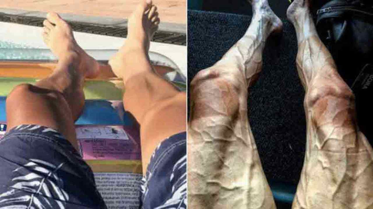 gambe ciclista tour de france